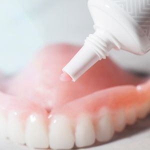 Permanent alternative to dentures